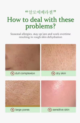 Aloe Vera Soothing Gel